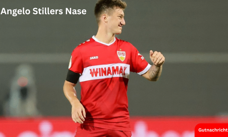 Angelo Stillers Nase